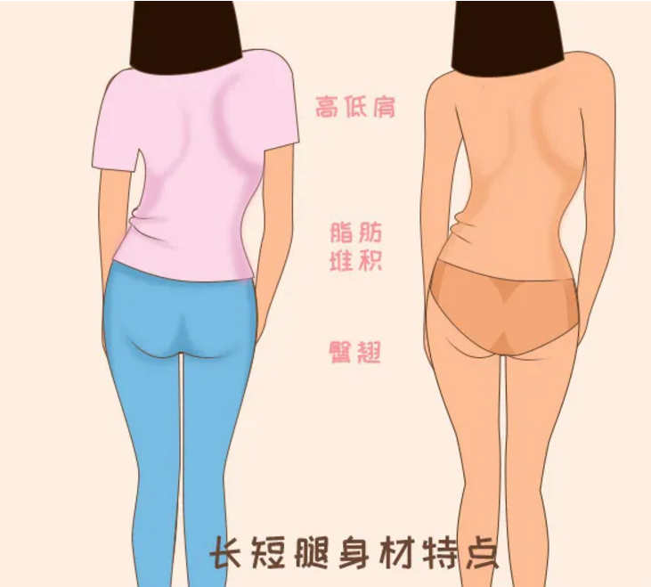 西安產(chǎn)后護理培訓(xùn)機構(gòu)-寶媽產(chǎn)后如果不注意這些事可能變長短腿！