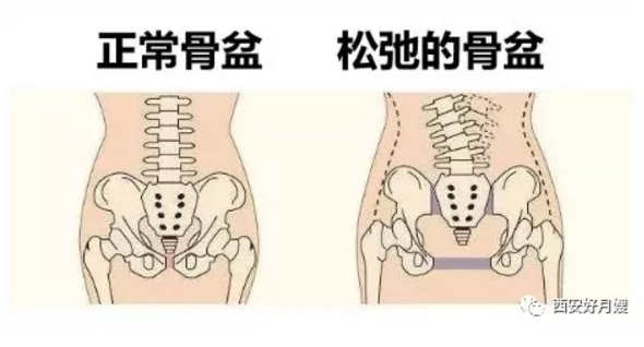西安產(chǎn)后康復(fù)培訓(xùn)-不容錯過丨產(chǎn)后修復(fù)的最佳時機，你掌握了嗎？
